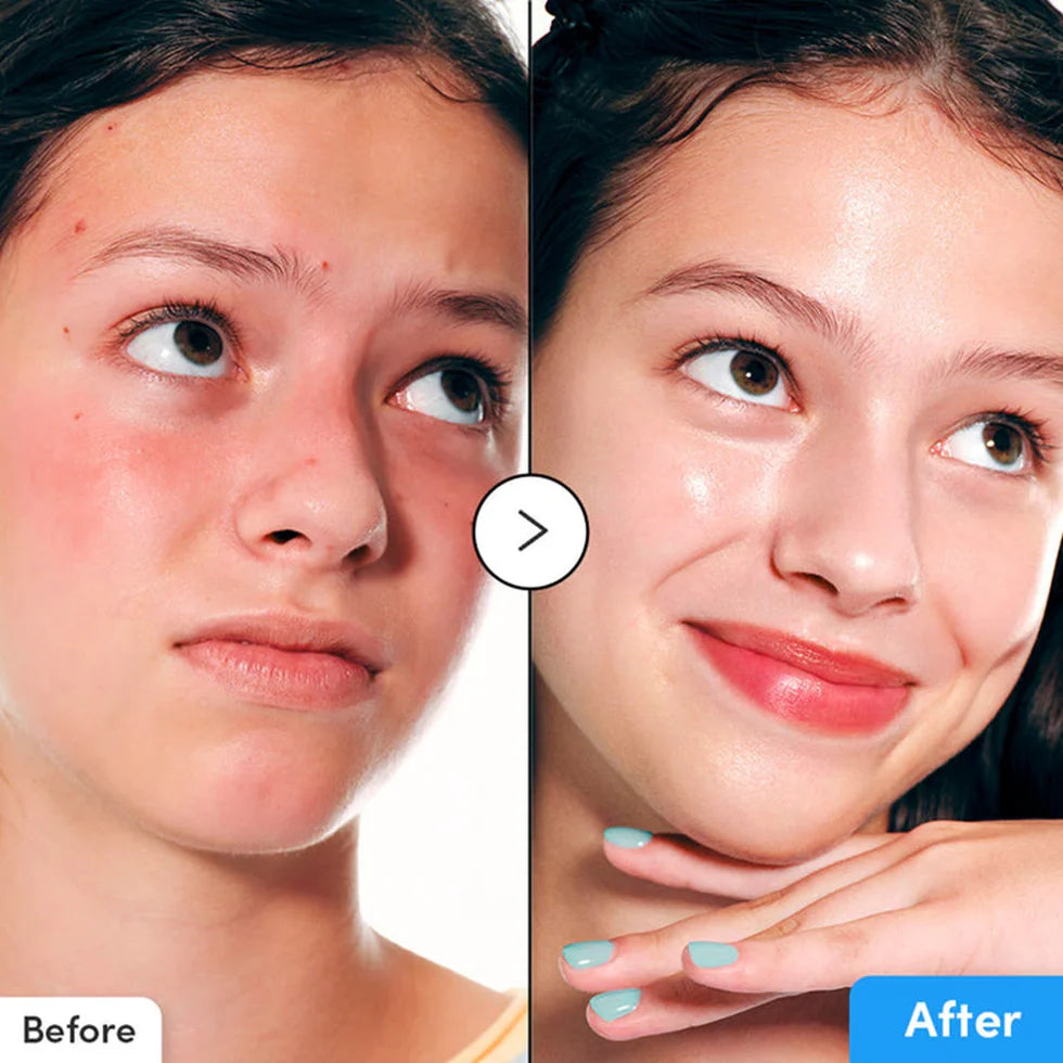 EQQUALBERRY BLUE BLOW HYALURON FLOODING SERUM