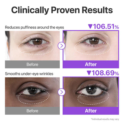 numbuzin NAD+ Collagen Under Eye Patches (5 Pairs)