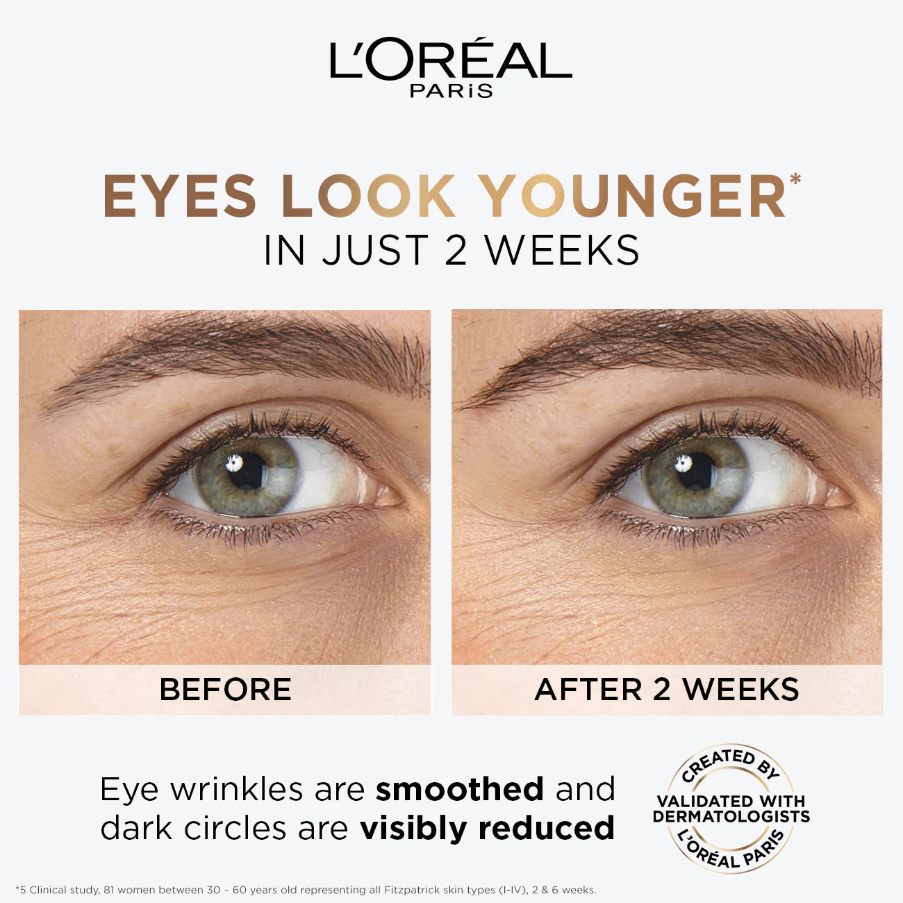 HYALURON EYE CREAM